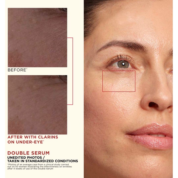Clarins Double Serum 50 ml ansigtsserum mod rynker viser effekt på huden under øjet med før og efter billeder