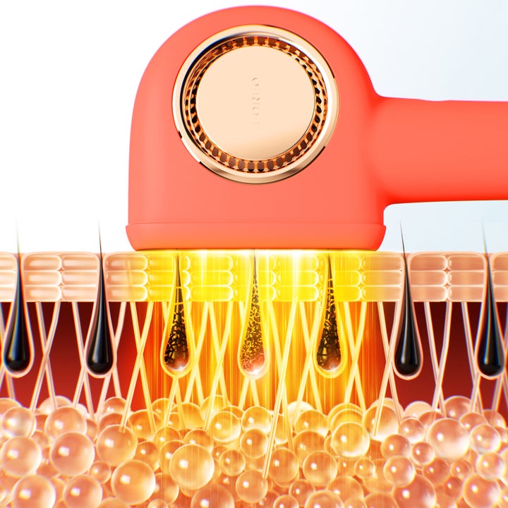 FOREO PEACH 2 Pro Max hårfjerner til beauty tech der sender lys ned i hudlagene for effektiv behandling