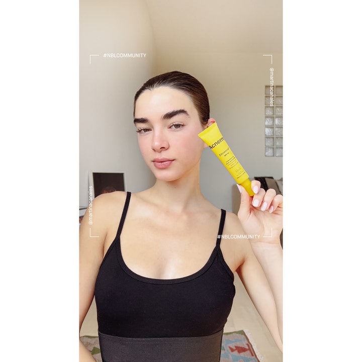 Niche Beauty Lab Acnemy Zitcontrol 40 ml ansigtscreme i gul tube holdt af en kvinde i hverdagsmiljø