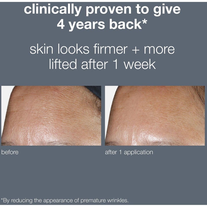 Dermalogica Phyto Nature Oxygen Cream før og efter resultater der viser reducerede rynker og fastere hud på panden.