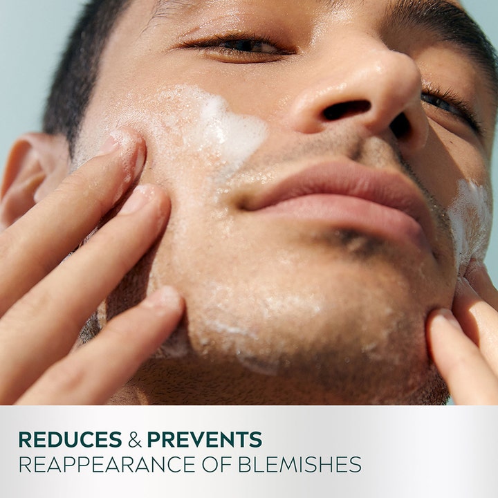 NIVEA Derma Skin Clear Wash Gel 150 ml ansigtsrens der reducerer urenheder på en mands ansigt.