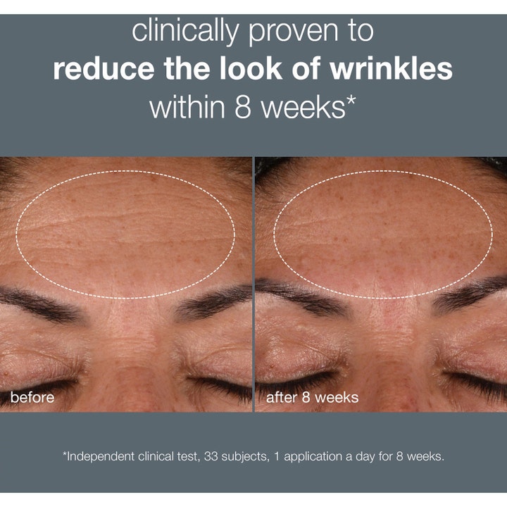Dermalogica Dynamic Skin Recovery SPF50 15 ml dagcreme reducerer rynker vist med før og efter billeder af panden
