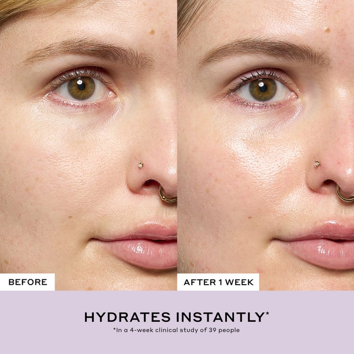 Ole Henriksen Strength Aprés-Skin Rich Rescue Treatment 75 ml fugtgivende ansigtscreme før og efter resultat