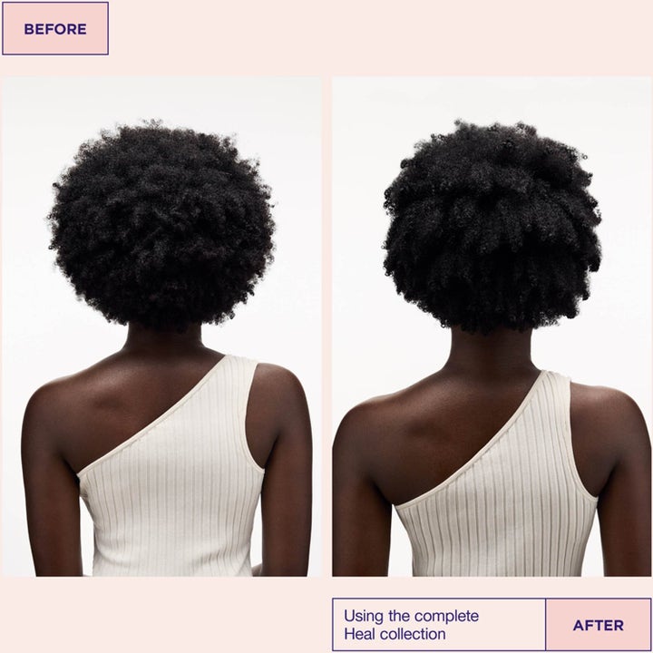 Head & Hair Heal Kit