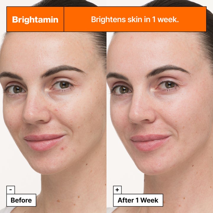 Dr.Jart+ Brightamin Brightening Serum Ampoule 8,08 g giver glød i en før og efter sammenligning af ansigtet.
