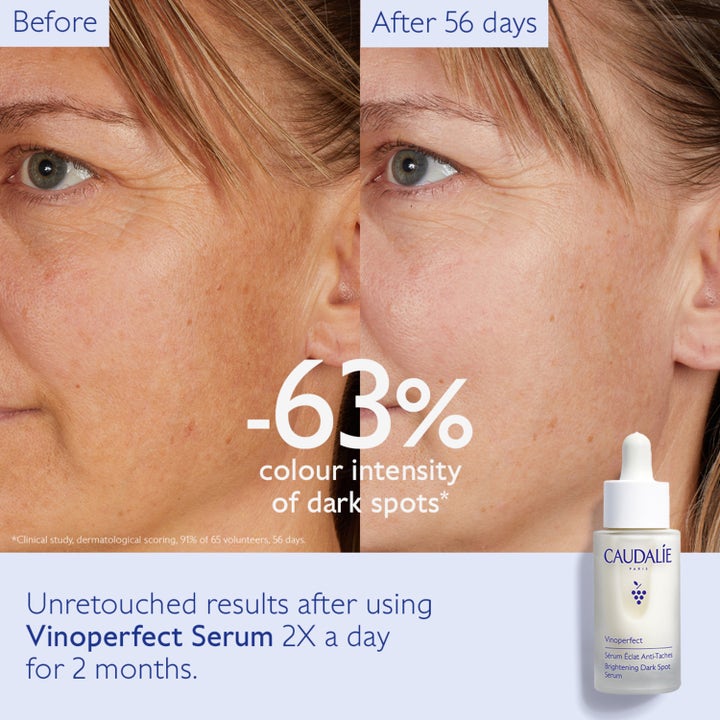 Caudalie Vinoperfect Radiance Serum 30 ml mod mørke pletter viser før og efter resultat med -63 % farveintensitet.