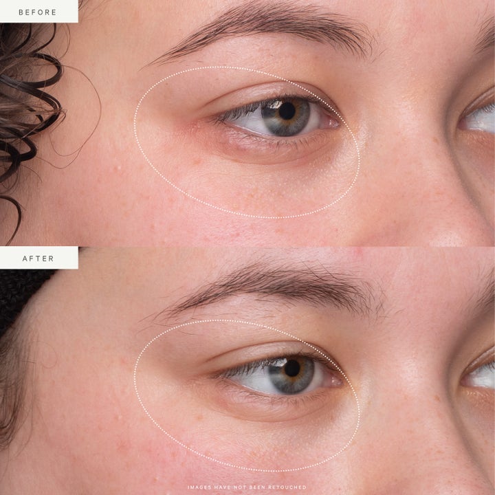 KORA Organics Kakadu Plum Vitamin C Eye Cream 15 ml øjencreme viser før og efter resultater på huden