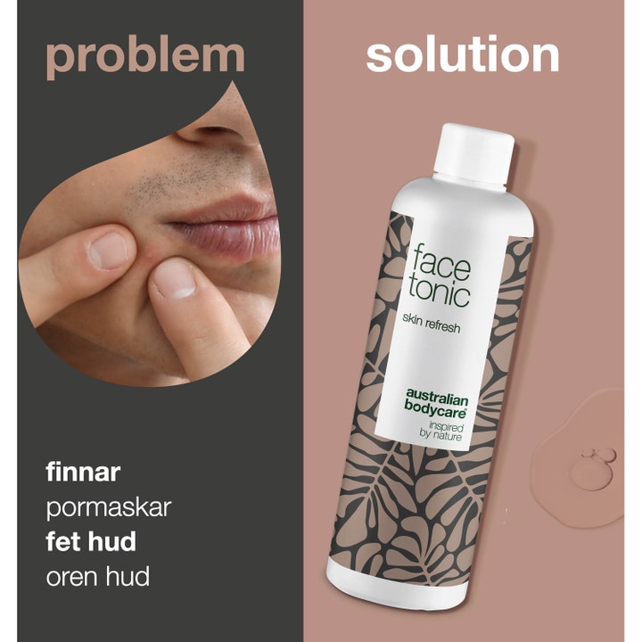 Australian Bodycare Face Tonic 150 ml ansigtsvand mod uren hud vist som løsning på bumser og fedtet hud