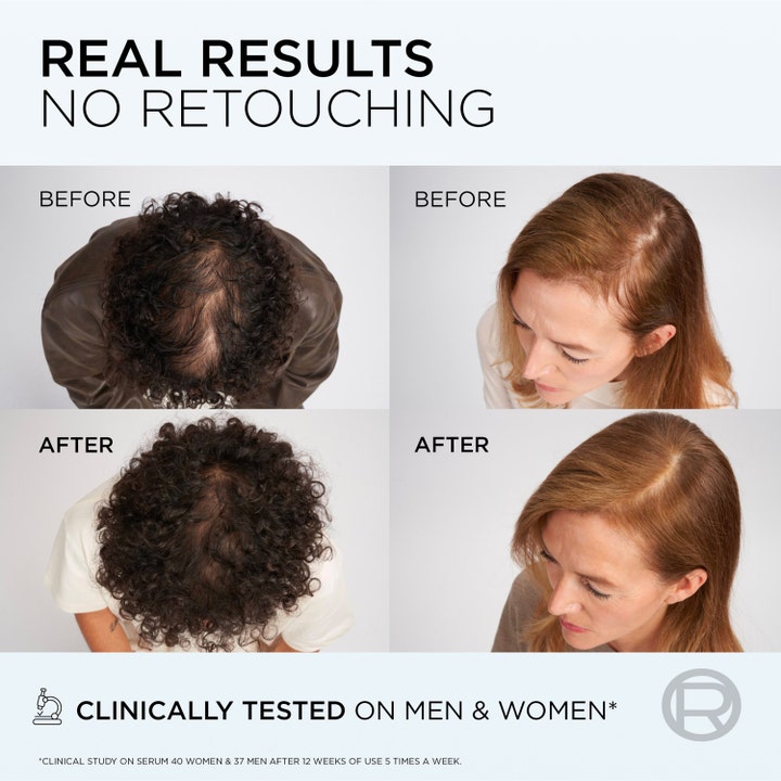 Elvital Growth Booster Conditioner