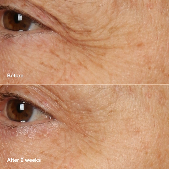 Clinique Smart Clinical Repair Overnight Recovery Cream 50 ml natcreme før og efter resultat på rynker efter 2 uger.