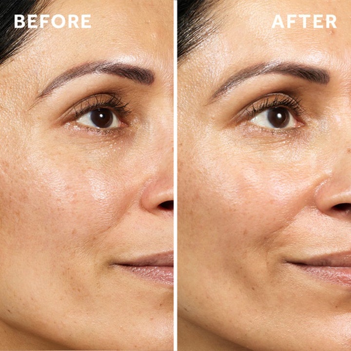 No7 Pure Retinol Triple Action Day Cream 100 ml før og efter resultat på hud med rynker og linjer