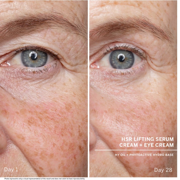Babor HSR Lifting Serum 30 ml opstrammende serum viser før og efter resultat på rynker ved øjet over 28 dage