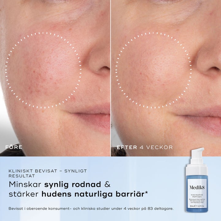 Niacinamide Peptides
