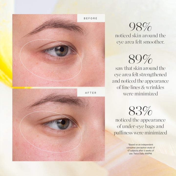 KORA Organics Kakadu Plum Vitamin C Eye Cream Refill 15 ml øjencreme før og efter resultater med glattere hud