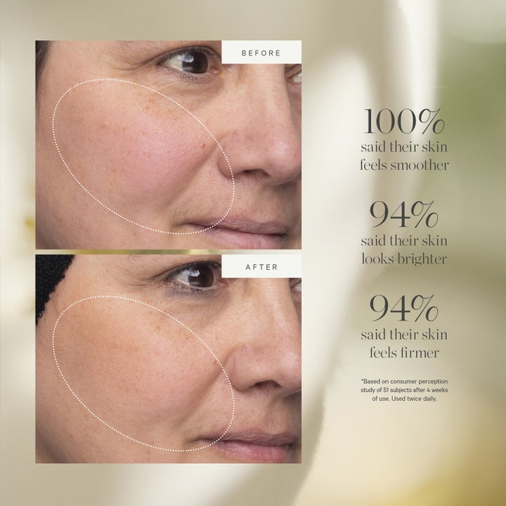 KORA Organics Turmeric Glow Moisturizer 15 ml dagcreme viser før og efter resultater for en glattere og fastere hud