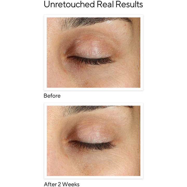 Murad Environmental Shield Vita-C Eyes 15 ml øjencreme mod mørke rande viser før og efter resultater på 2 uger.
