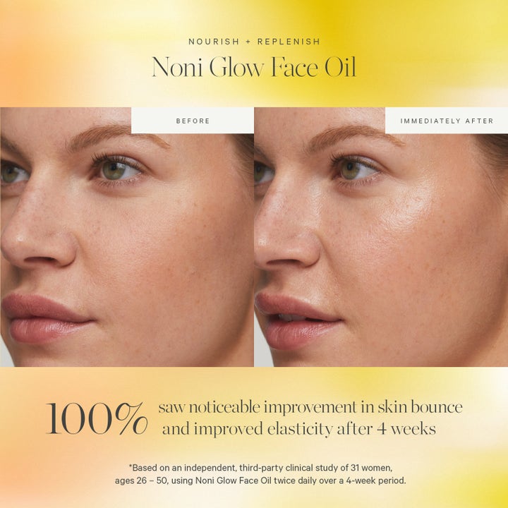KORA Organics Noni Glow Face Oil 10 ml ansigtsolie før og efter resultat der giver glød og elasticitet